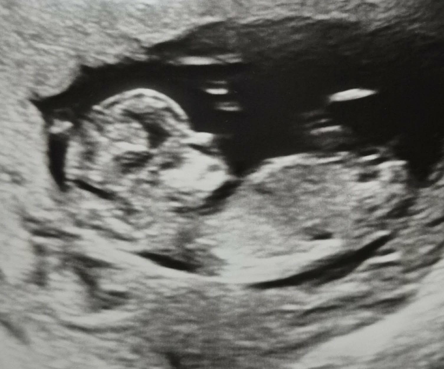 Sonogram